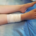 FOTO: Fetiță din Mediaș, la spital după ce a fost mușcată de un maidanez