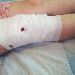 FOTO: Fetiță din Mediaș, la spital după ce a fost mușcată de un maidanez