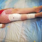 FOTO: Fetiță din Mediaș, la spital după ce a fost mușcată de un maidanez