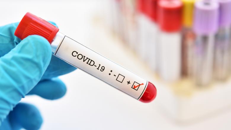 În acest moment se fac în medie aproximativ 350 de teste de COVID-19 pe zi