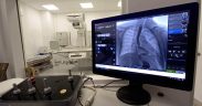 Noi dotări pentru radiologia Spitalului Clinic Județean de Urgență Sibiu
