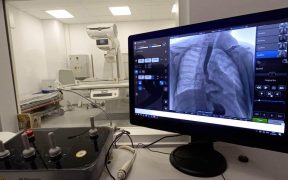 Noi dotări pentru radiologia Spitalului Clinic Județean de Urgență Sibiu
